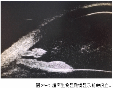 ZY016_150_3.gif